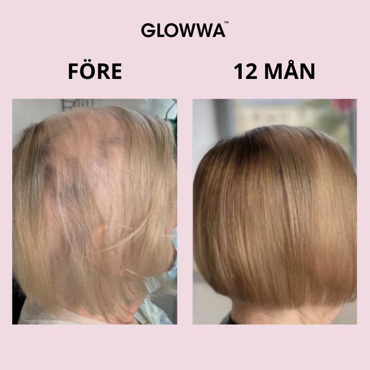 Hur slutar jag tappa hår